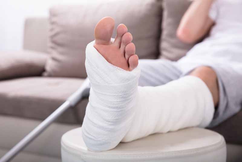 Sacramento personal injury lawyer injured woman with cast and crutches