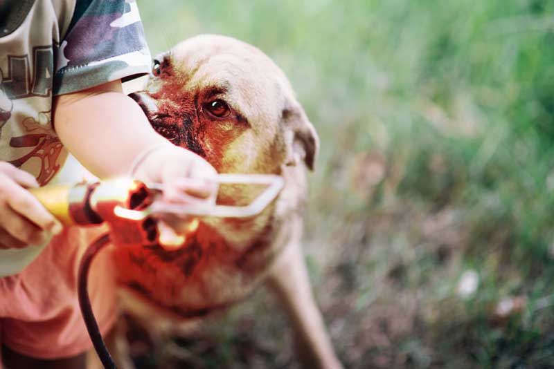 dog biting a child